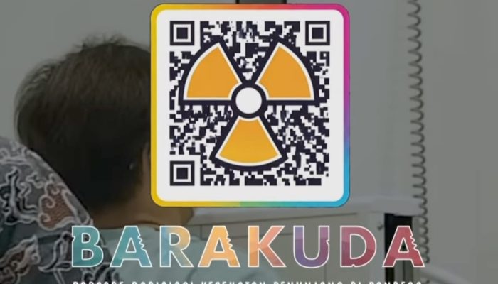 Inovasi Baru, RSUD Pandega Pangandaran Hadirkan Layanan BARAKUDA