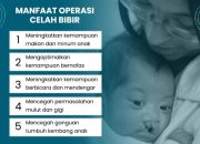 Sumbing Bawaan? Ini Manfaat Operasi Celah Bibir