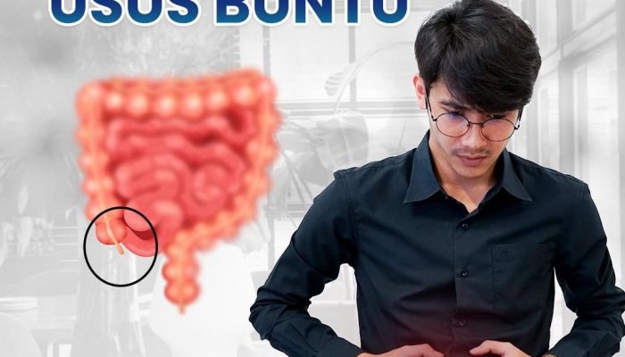 Lima Gejala Usus Buntu yang Harus Diwaspadai