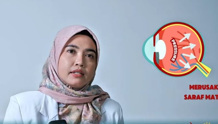 Perbedaan Glukoma dan Katarak